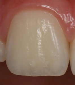 tand20compressed